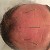 Are there any unique acupuncture techniques special benefit for dementia/ Alzheimer’s disease? Q17