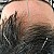 How frequently of the acupuncture treatment do I need to take? Q16