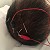 What’s the benefit of scalp acupuncture for dementia/Alzheimer’s disease? Q18