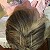 What’s the benefit of acupuncture for dementia and Alzheimer’s disease? Q13