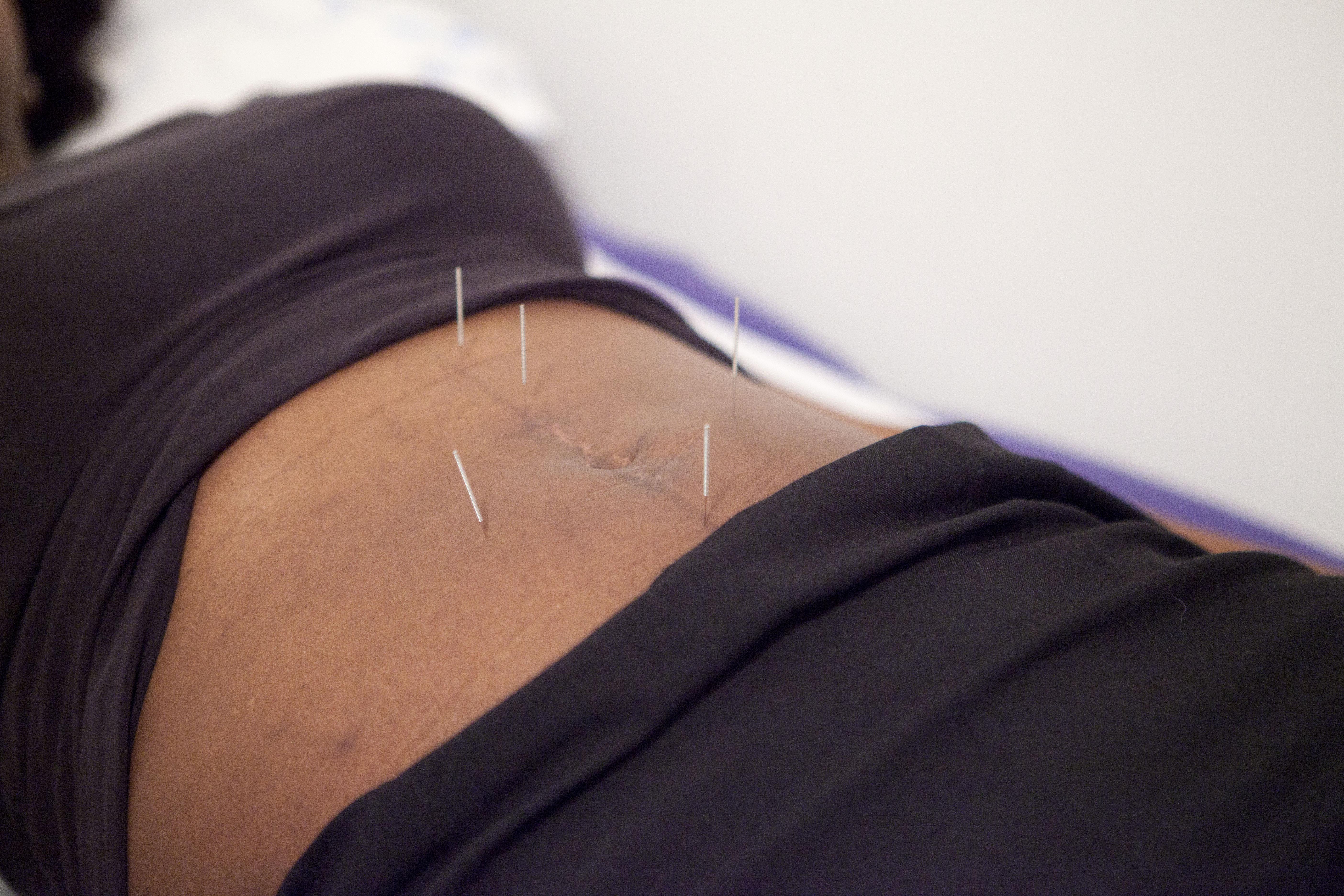 Pain Management